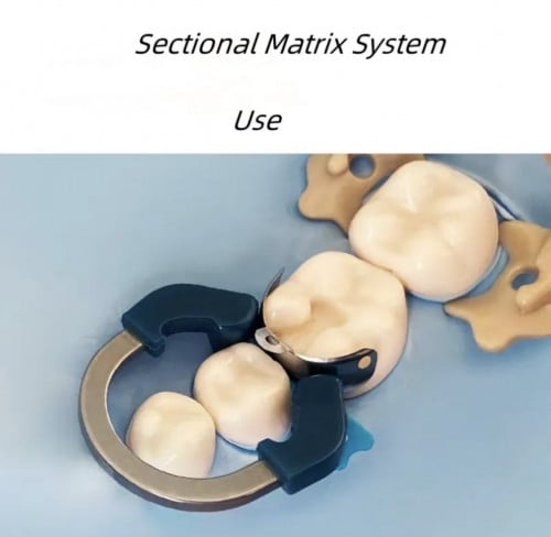 Dental sectional matrix full kit