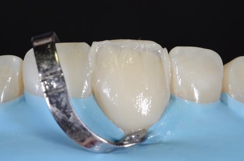 ربر دام الاحترافي rubber dam