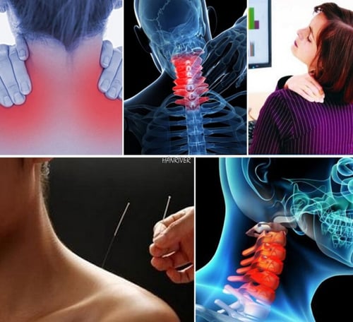 دعامة الرقبة الحرارية