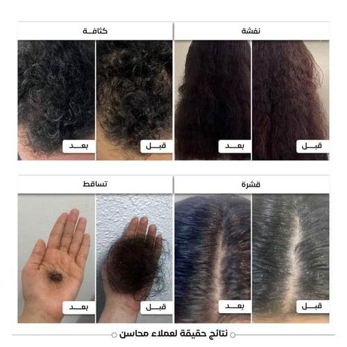 محاسن زيت الشعر كثافة و تحفيز و نمو الشعر وإطالته