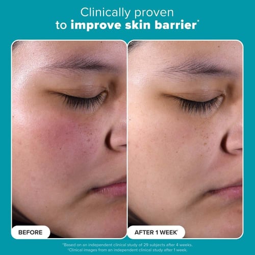 مقشر باولا تشويس محلول مقشر للبشره 2% - 118مل