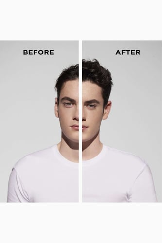 كيراستاس شامبو سبيسيفيك انتي غراس بان ديفالنت، 250...