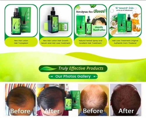 جرين ويلث لوشن نيو هير لوشن علاج جذور الشعر - 120...