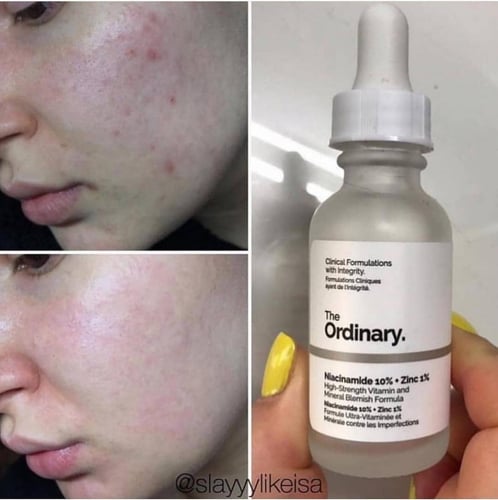 ذا اوردينري محلول نياسيناميد 10٪ زنك 1٪ - 30 مل