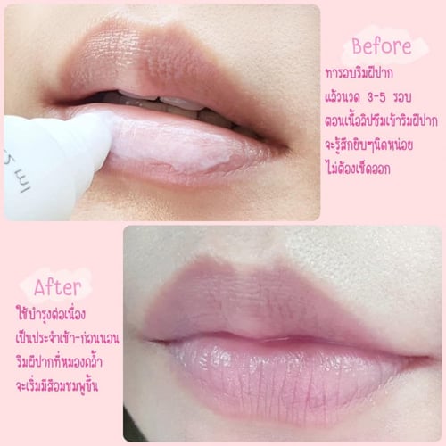 ديرموفيوتشر مكبر الشفاه بحمض الهيالورونيك 12مل