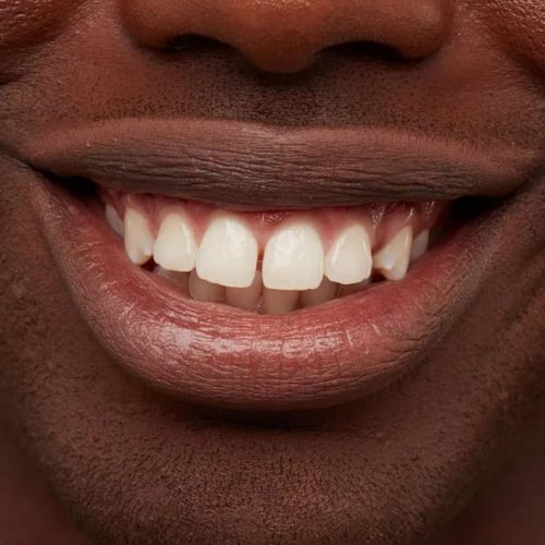 نيكس قلم تحديد الشفاه SPL855 - نود تروفلي