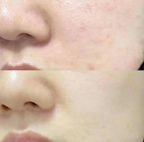 مقشر باولا تشويس محلول مقشر للبشره 2% بي اتش ايه -...