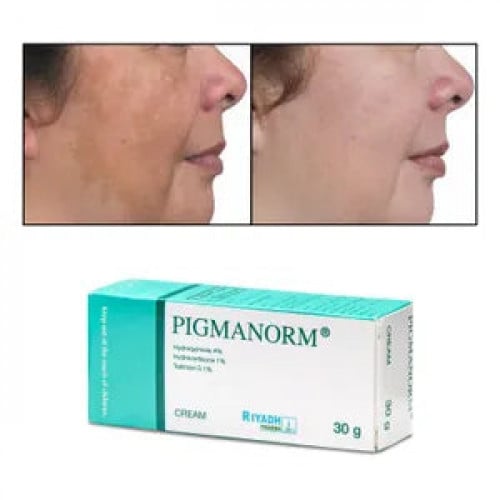 كريم بيجمانورم لويس وايدمر - 30 مل