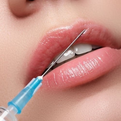 فيلر جوفيدرم 1 مل