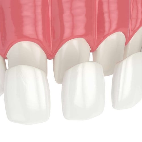 تركيبات برسلان السن الواحد