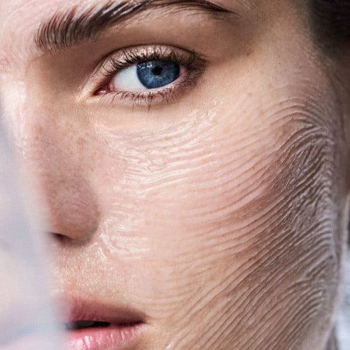 جلسة فراكشنال ليزر مع ابرة نضاره