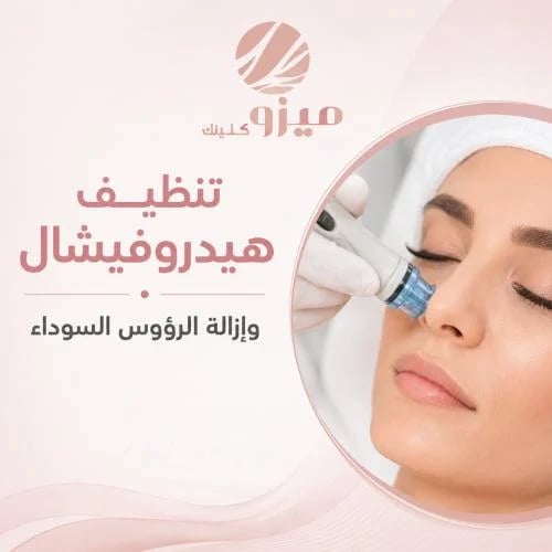 التنظيف الهيدروفيشال