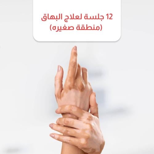 12 جلسة لعلاج البهاق (منطقة صغيره)
