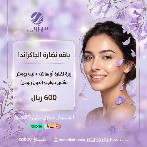 باقة نضارة الجاكرندا
