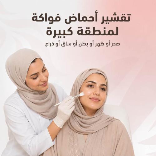 تقشير أحماض فواكة لمنطقة كبيرة (صدر أو ظهر أو بطن...