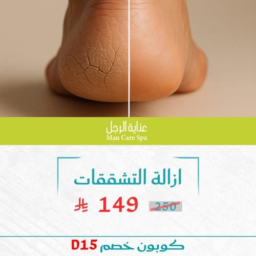 باقة ازالة التشققات