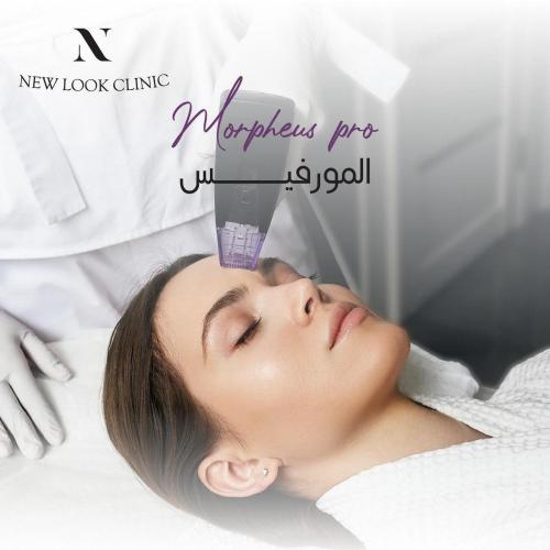 مورفيس