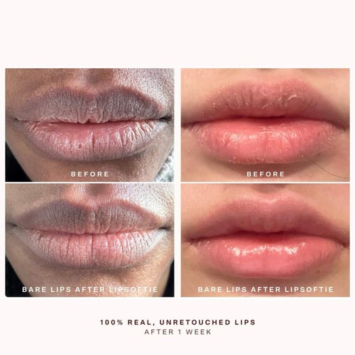 مجموعة العناية بالشفاه الملونة ميني ليل سوفتيز Tow...