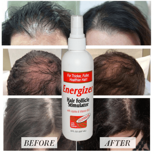 بخاخ انرجايزر محفز لبصيلات الشعر مع الجوجوبا