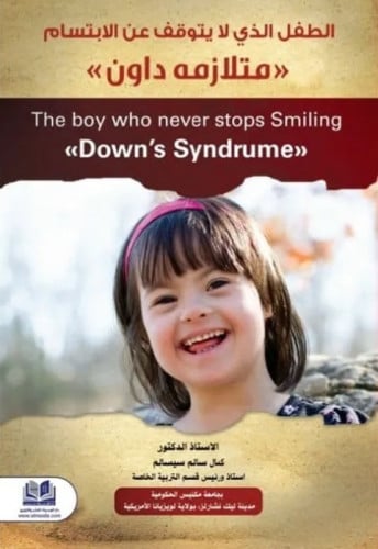 الطفل الذي لا يتوقف عن الابتسام "متلازمة داون"