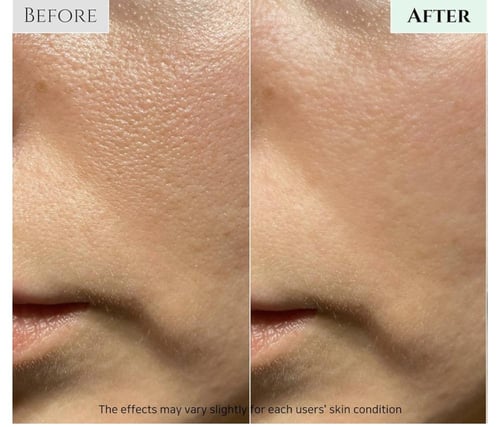 غسول البشره الحساسه