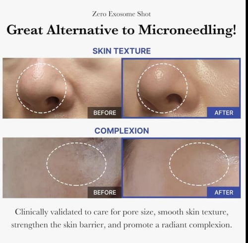 ميديكيوب – امبولة اكسوسوم لتعزيز اصلاح البشرة البش...