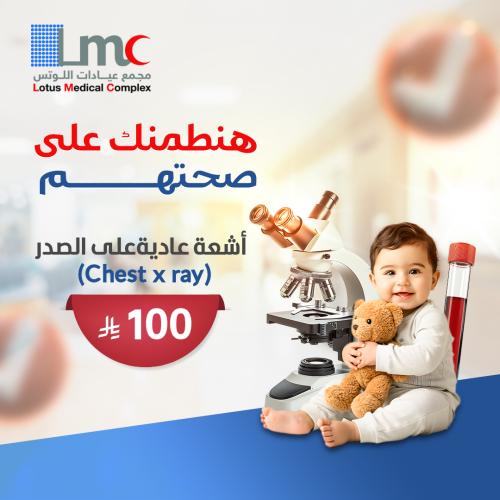 Chest x ray اشعه عاديه على الصدر