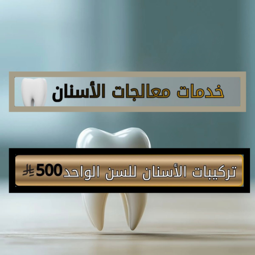 Single tooth dental implants