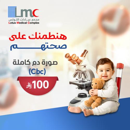 Cbc صوره دم كامله