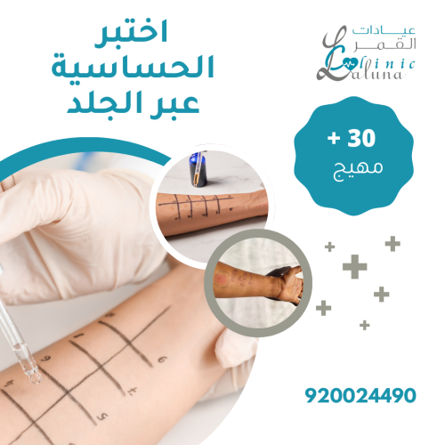 اختبار الحساسية عن طريق الجلد لأكثر المهيجات الشائ...