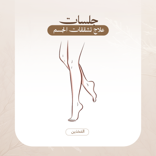 جلسات علاج تشققات الجسم (الافخاد كامله)