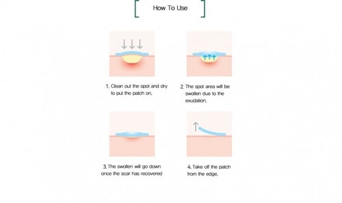 لصقات المعجزة لإزالة حب الشباب من سوم باي مي - 18...