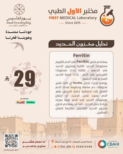 مخزون الحديد