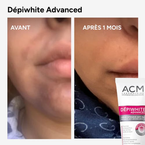 كريم ACM Laboratoire Dermatologique Dépiwhite Adva...