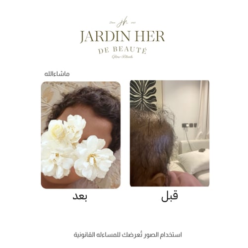 زيت الإنبات