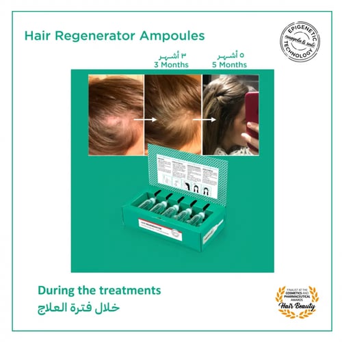 أمبولات تجديد الشعر - مجموعة 4 أمبولات