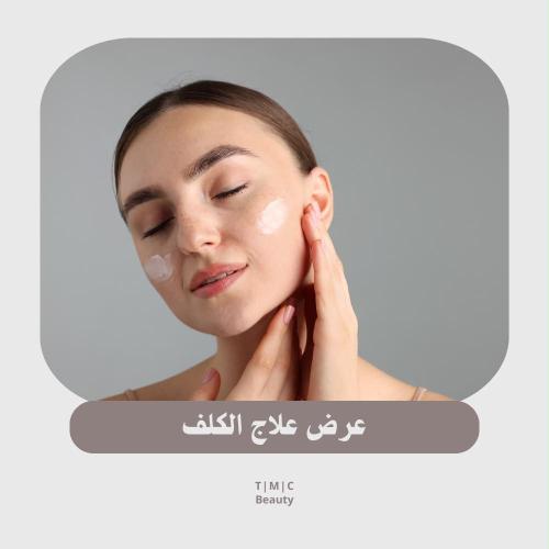 علاج الكلف