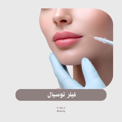 Tissue filler