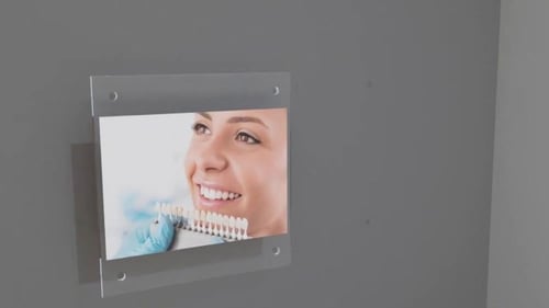 مسامير تثبيت ديكورية من الستانلس ستيل