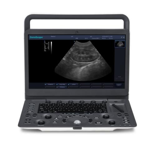 جهاز E1V من SonoScape