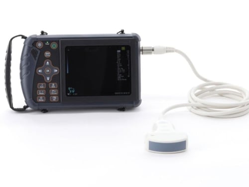 جهاز الفحص الترا