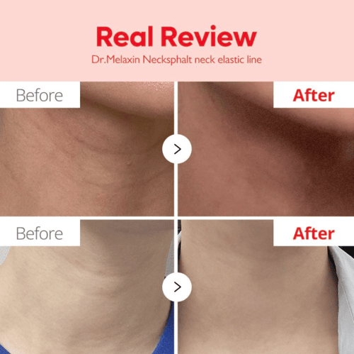 كريم شد البشرة للعناية بالمسام والتجاعيد من دكتور...