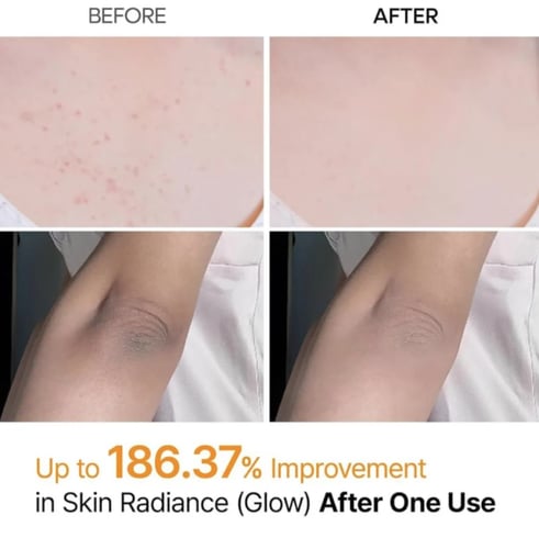 مجموعة دكتور ميلاكسين للتفتيح والتقشير بالأرز والك...