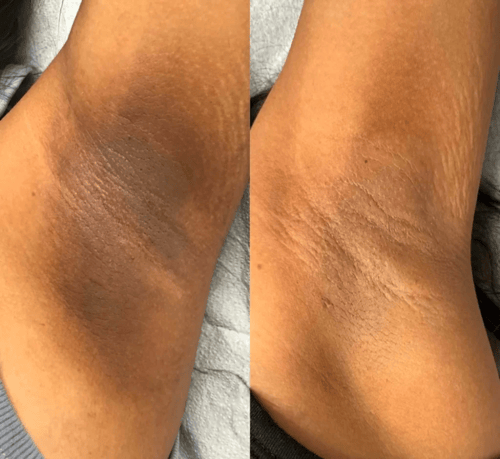 كريم لتفتيح وتوحيد لون البشرة – إزالة البقع الداكن...