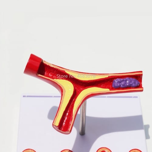 نموذج متقاطع لمرض القلب -model of heart disease