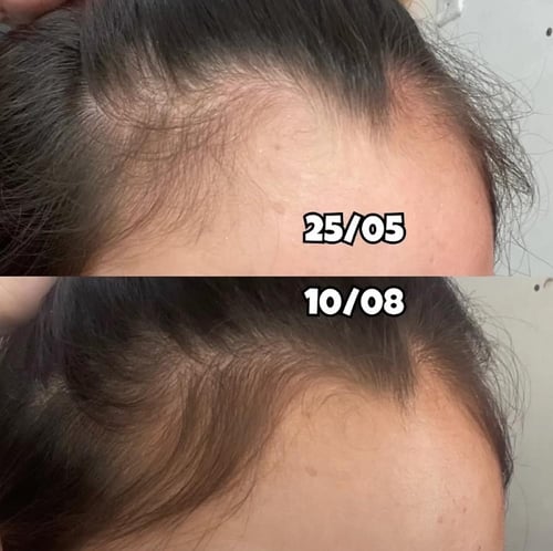 مجموعة تونيكو - تونيك وتونك- متعدد - القوة المثالي...