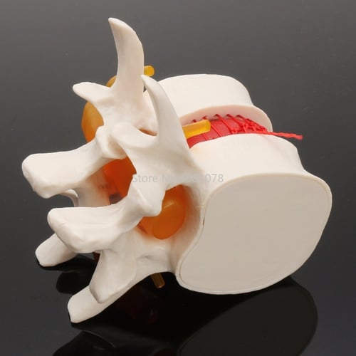 نموذج تشريحي لطب الأسنان-Dental anatomical model
