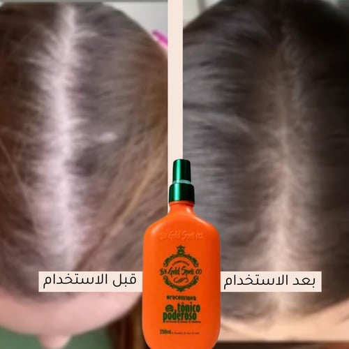 Tonico Poderoso - منع تساقط الشعر والصلع وانبات ال...