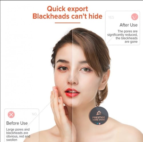 جهاز إزالة الرؤوس السوداء