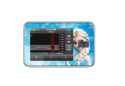 ستكر مضخة تاندم